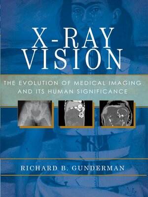 cover image of X-Ray Vision
